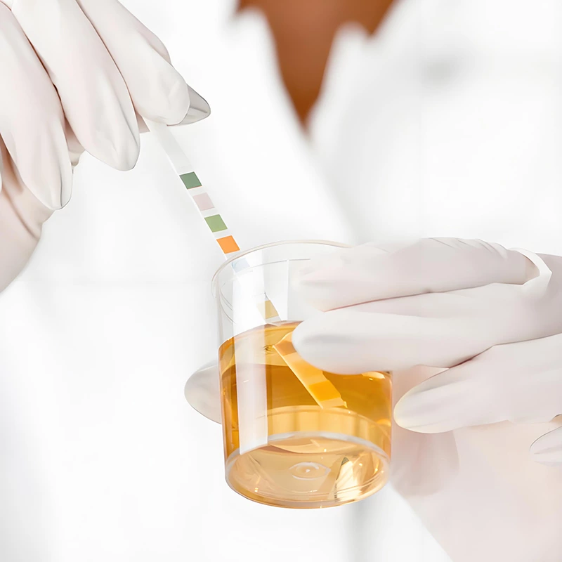 Urinalysis Test Strip