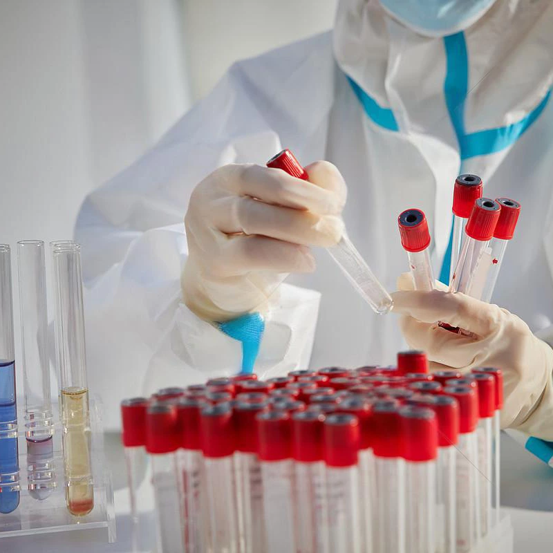 Infectious Disease Test