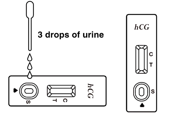 Diagnos HCG Pregnancy Test(Cassette)